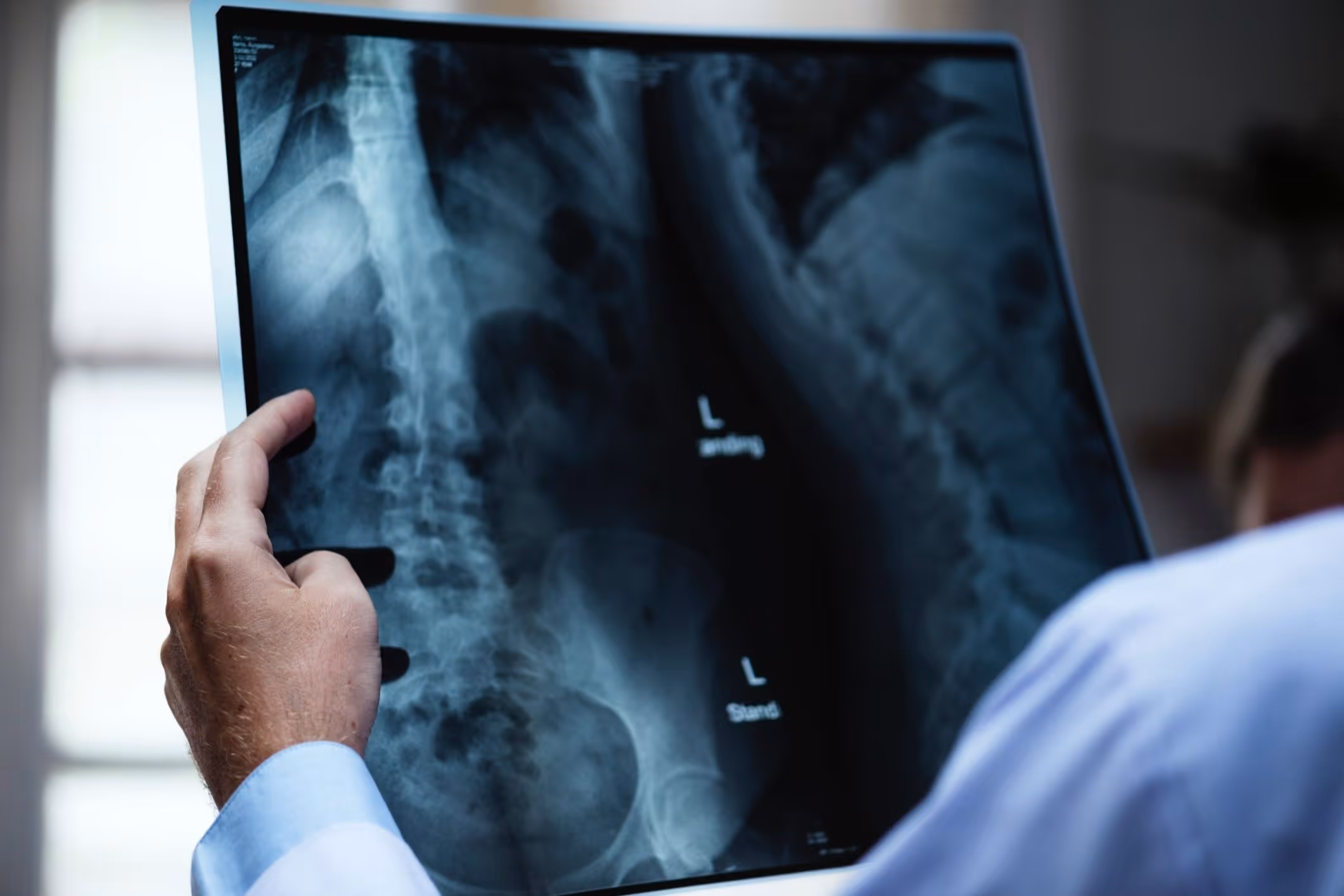 Lung x ray examined by a doctor