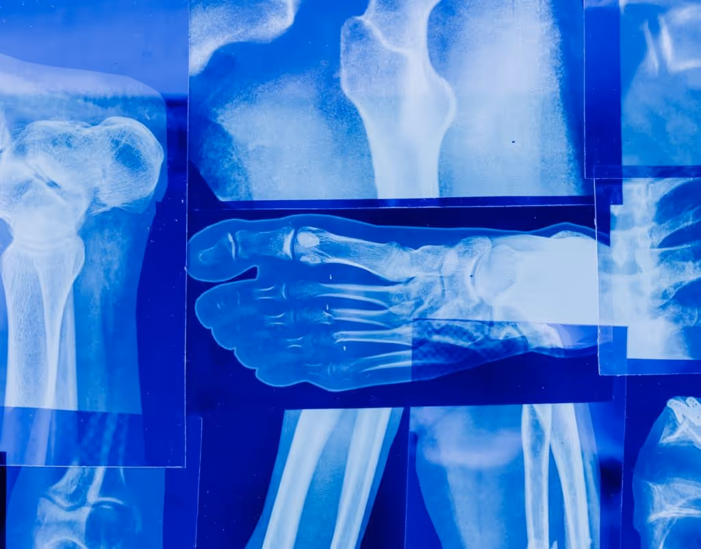 x-ray