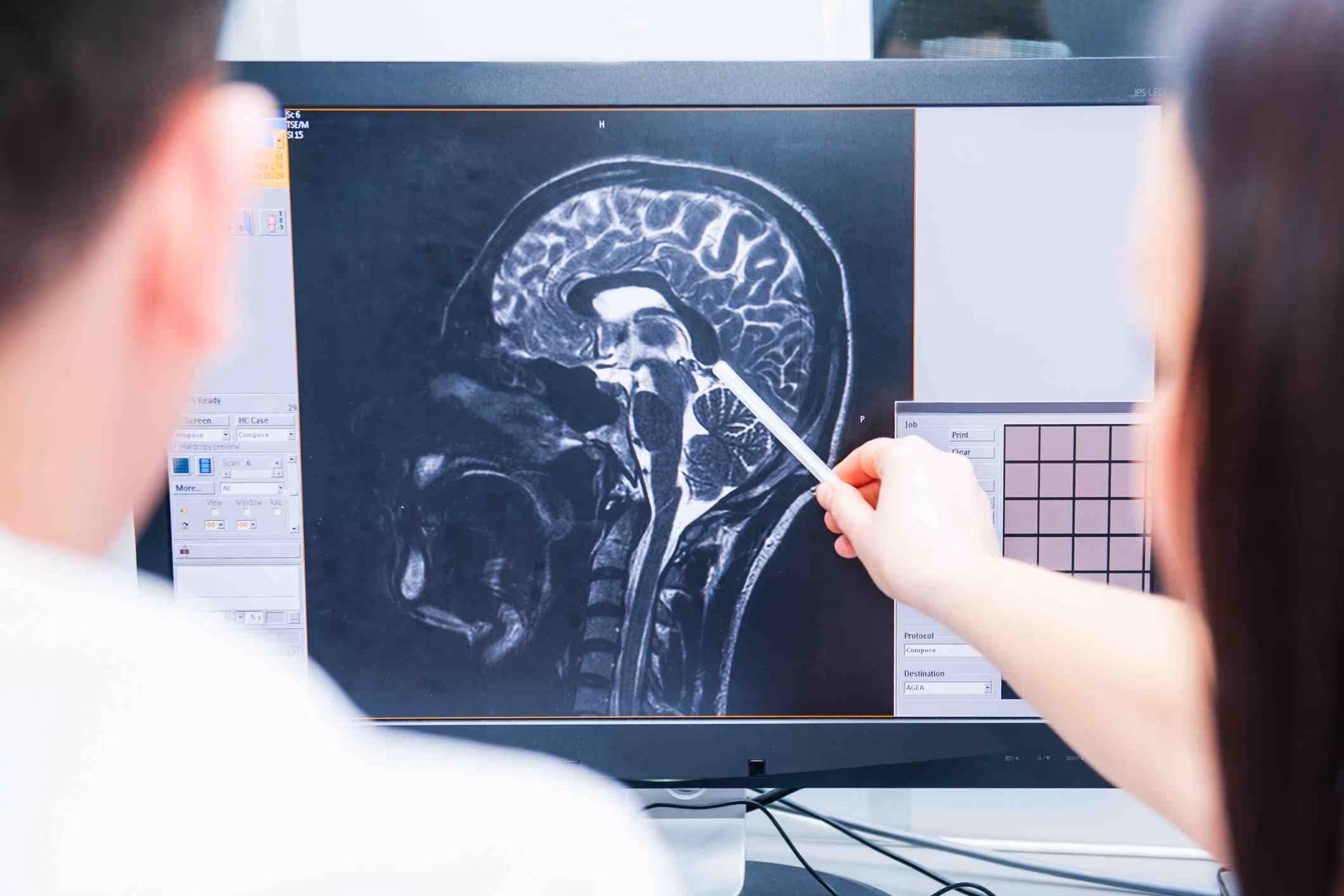 brain scan results