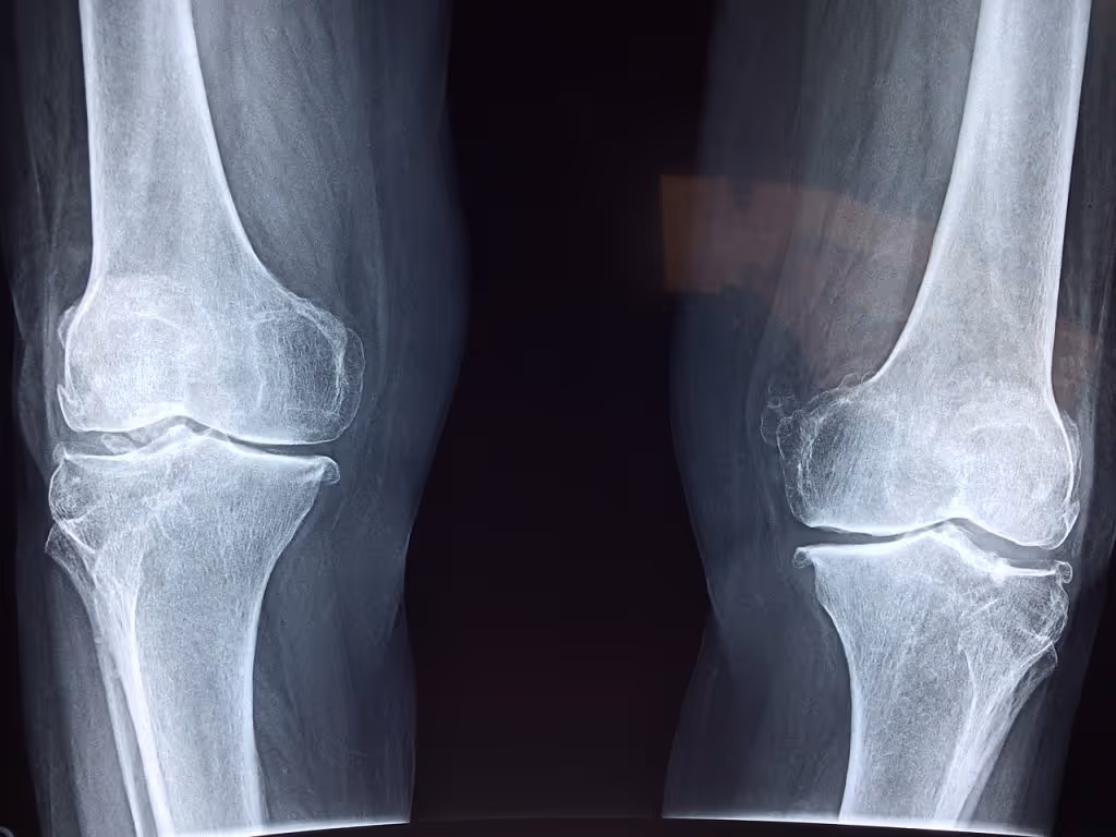 x-ray