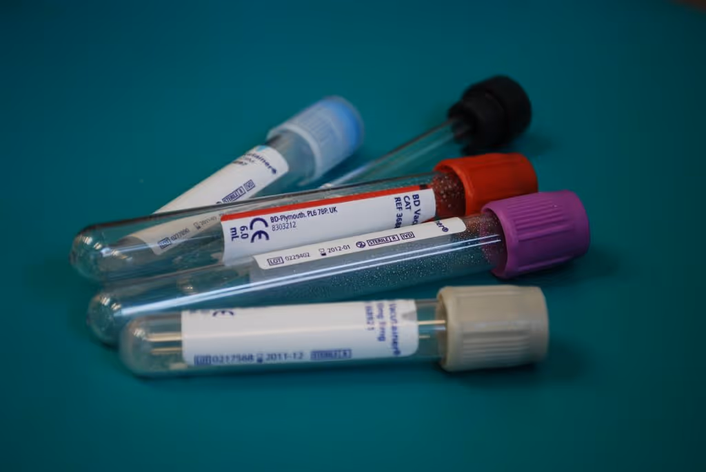 hospital acquired infections blood incompatibility