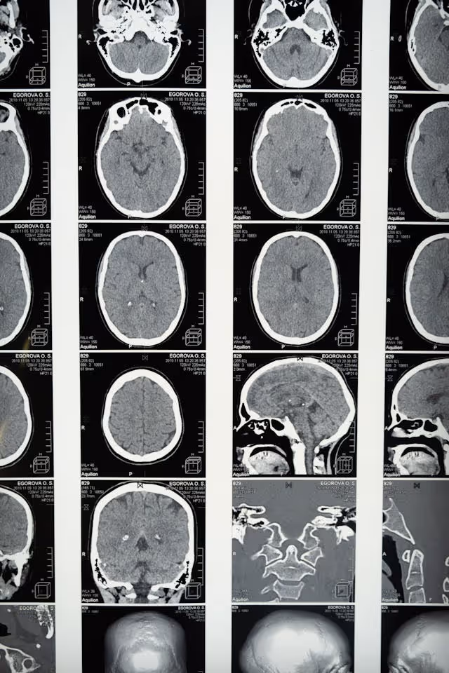 doctor reviewing brain scan