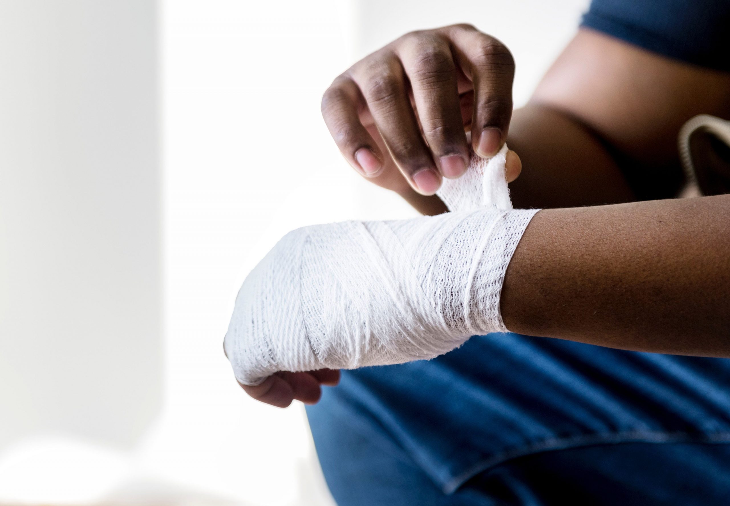 The Lyon Firm is investigating burn injury claims involving the Casely Power Pod (Model E33A) recall. If you were burned by a defective lithium-ion power bank, contact our Cincinnati product liability attorneys for a free consultation — we represent clients nationwide.