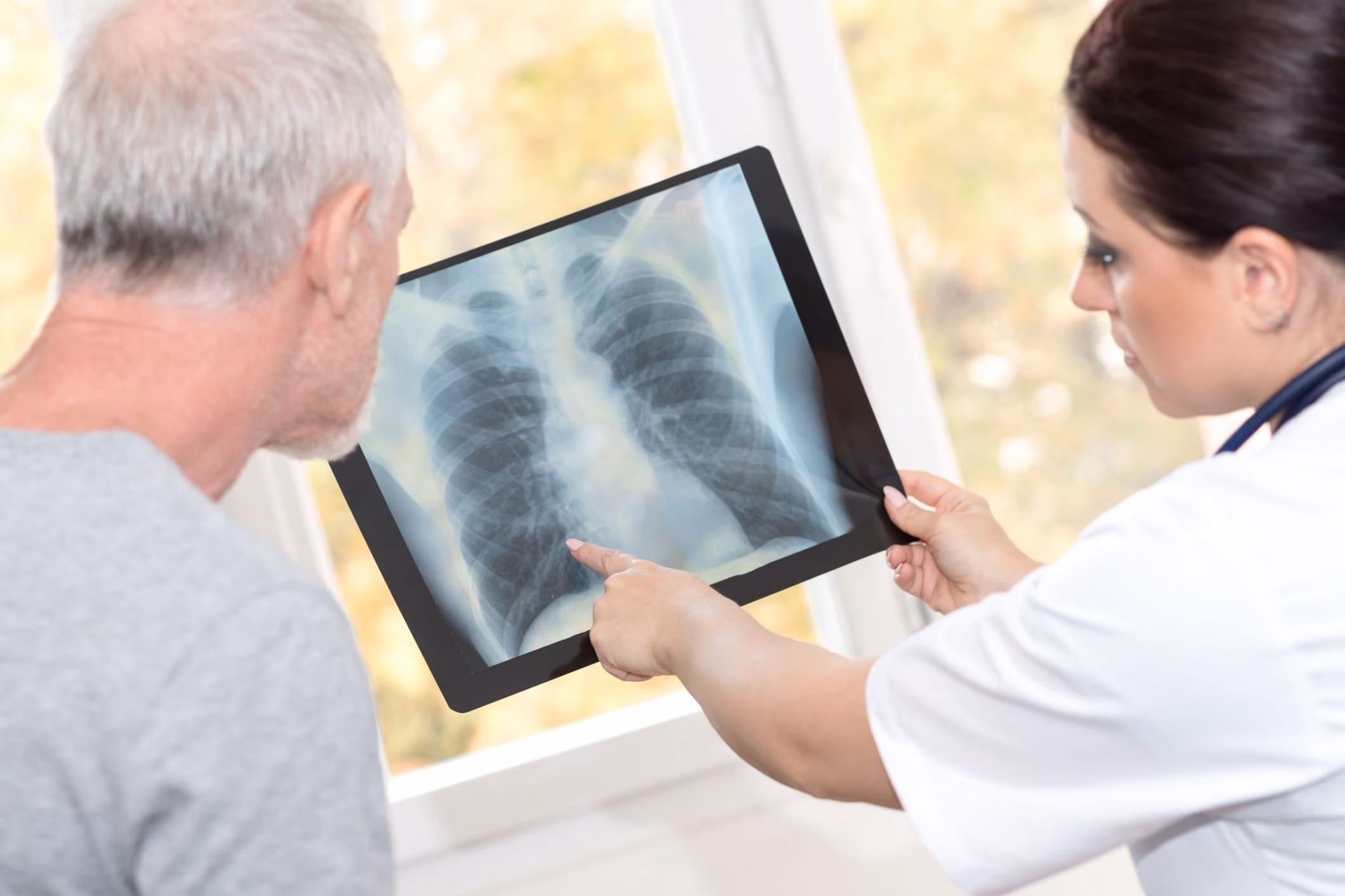 The Lyon Firm secured a settlement over $3,271,704 for the family of a steel worker who died of pleural mesothelioma after decades of asbestos exposure