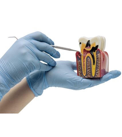 Modele dentare artificiale cu gingii roz și dinți albi pe fundal negru.