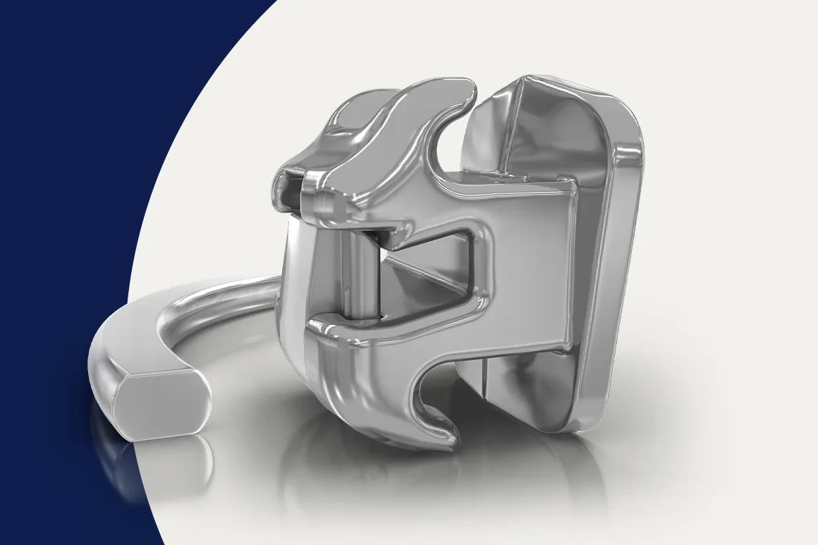 Damon Ultima™ self-ligating bracket with a rounded-rectangular archwire