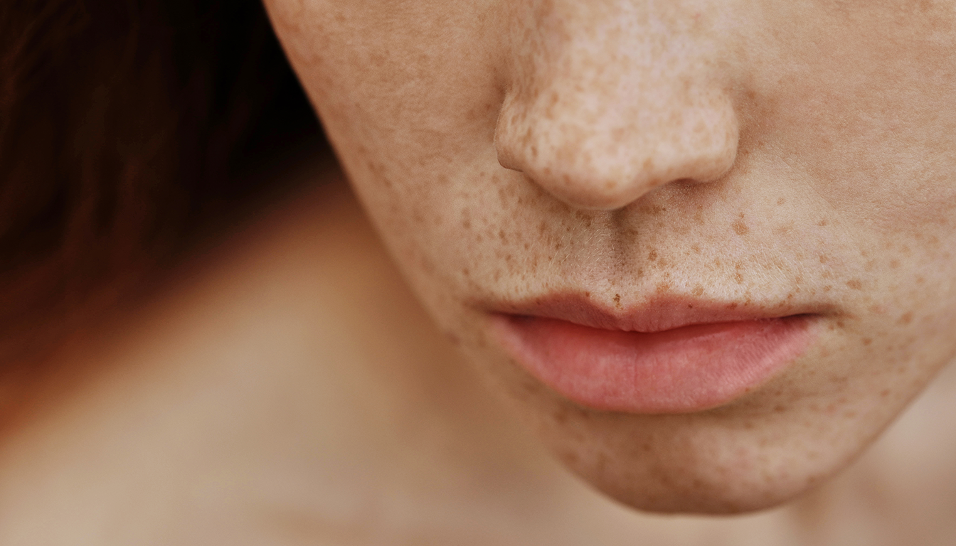 Pigmentflecken: Was du wissen solltest und welche Ansätze es gibt