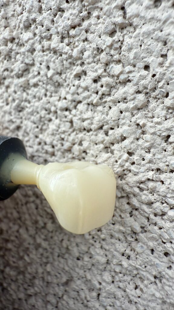 This is a photo of a milled Crown for teeth