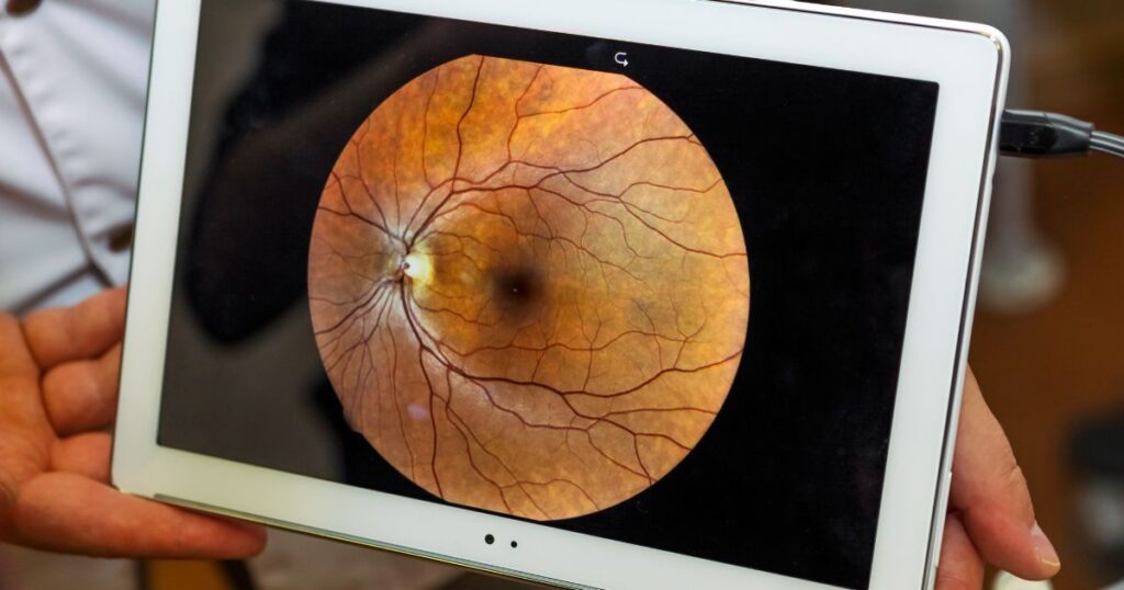 person holding an ipad with an image of an oct scan on it