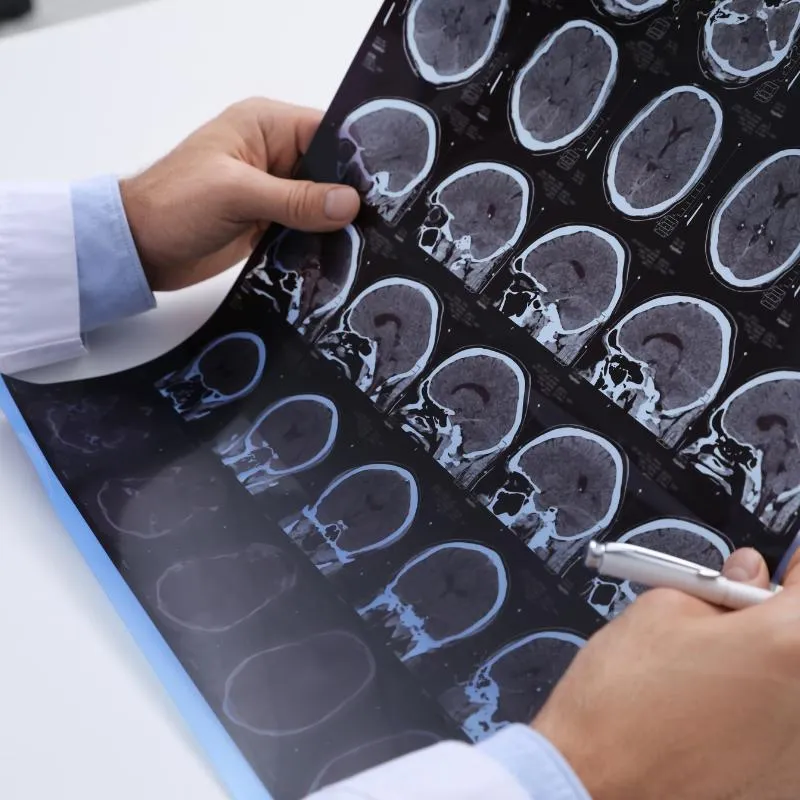 Health professional looking at MRI scan