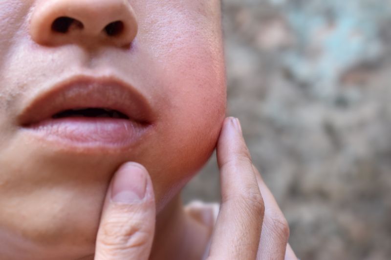 Dental Abscess Symptoms You Shouldn’t Ignore