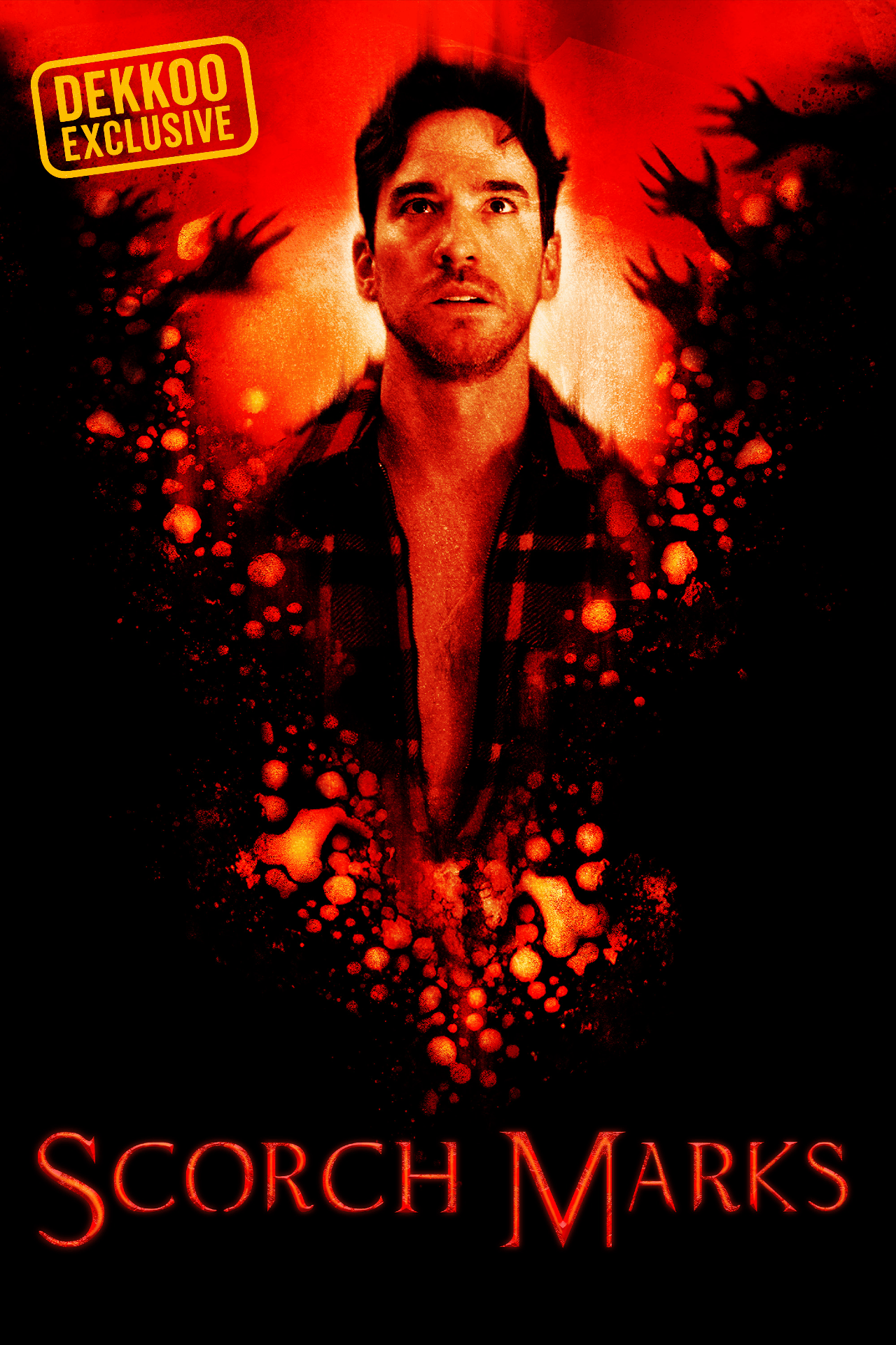 Promotional artwork for the Dekkoo Exclusive Scorch Marks, featuring a man surrounded by fiery red and orange imagery against a black background.