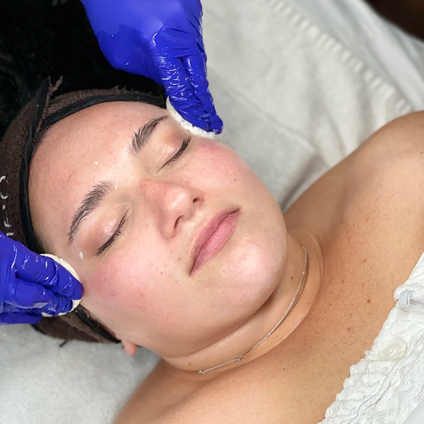 Person with eyes closed receiving a facial treatment from hands wearing blue gloves.