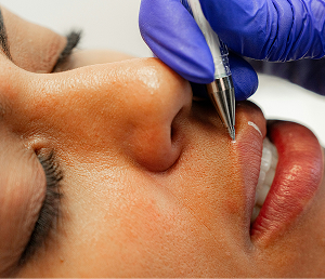 Close-up of a person receiving a lip tattoo or permanent makeup application with a pen tool.