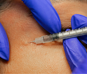 Gloved hands injecting clear liquid into skin with a syringe needle.