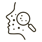 Profile of a face with acne spots highlighted by a magnifying glass icon.