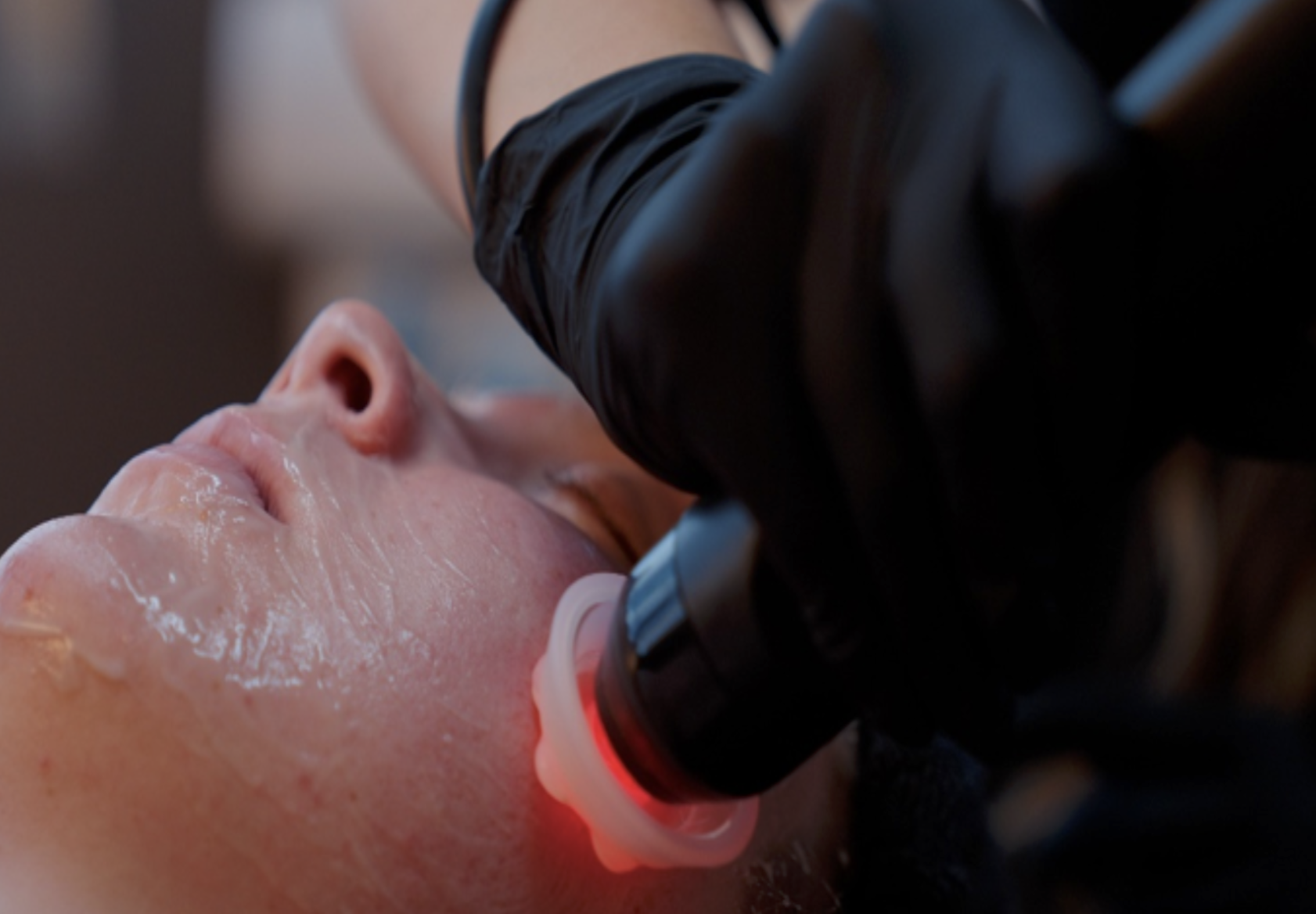 Person with eyes closed receiving a facial treatment from hands wearing blue gloves.