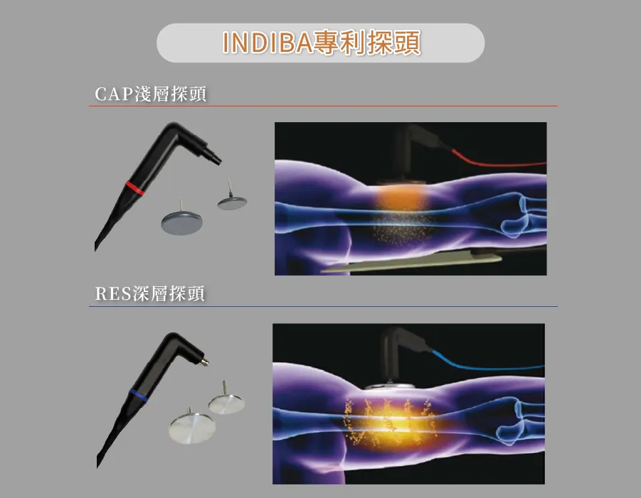 INDIBA 英特波搭載專利 Proionic® 系統,可依照治療部位與目標,選擇 CAP 淺層治療探頭或 RES 深層治療探頭