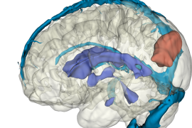 image of brainstorming session (for a productivity tools business)