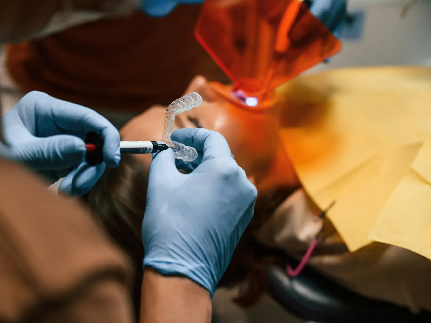 Dentist wearing gloves applying whitening gel to a dental tray near a patient’s mouth with light shield.