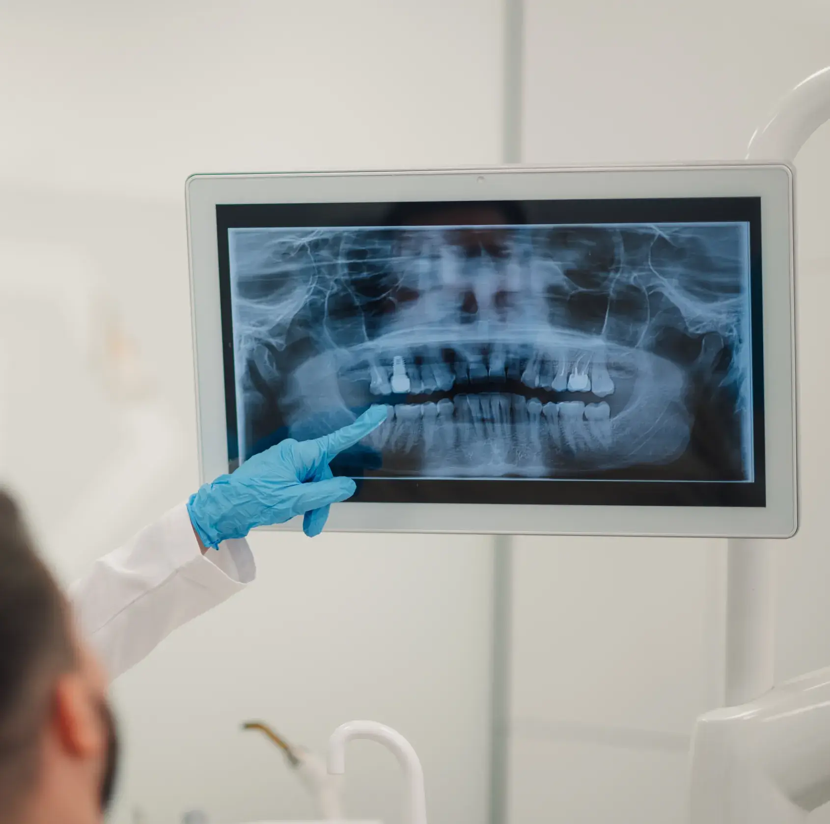 Gloved hand points at a dental X-ray showing teeth and dental implants on a monitor screen.