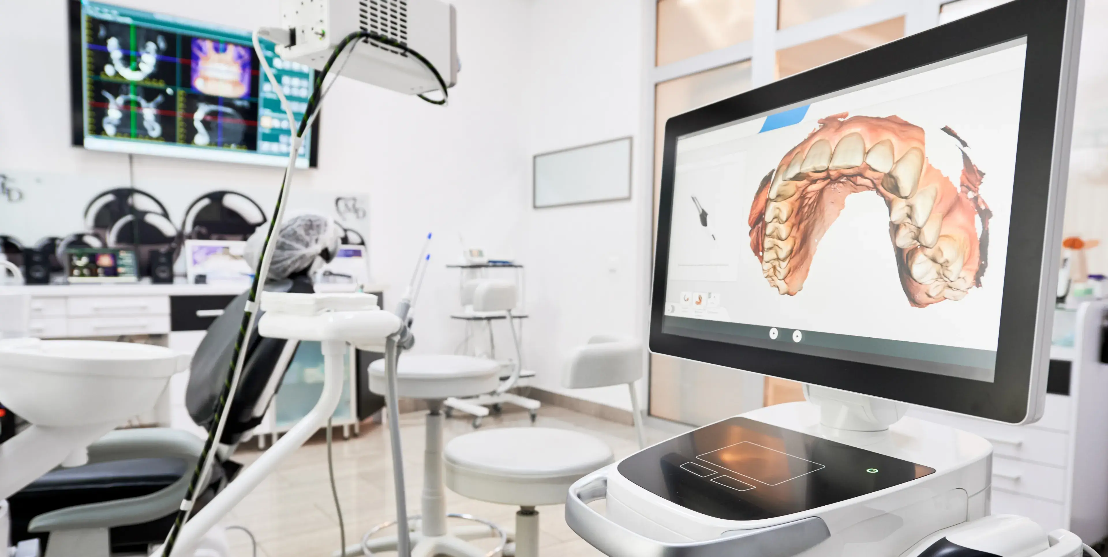 Dental clinic with a chair and monitor displaying a 3D digital scan of upper teeth and gums.