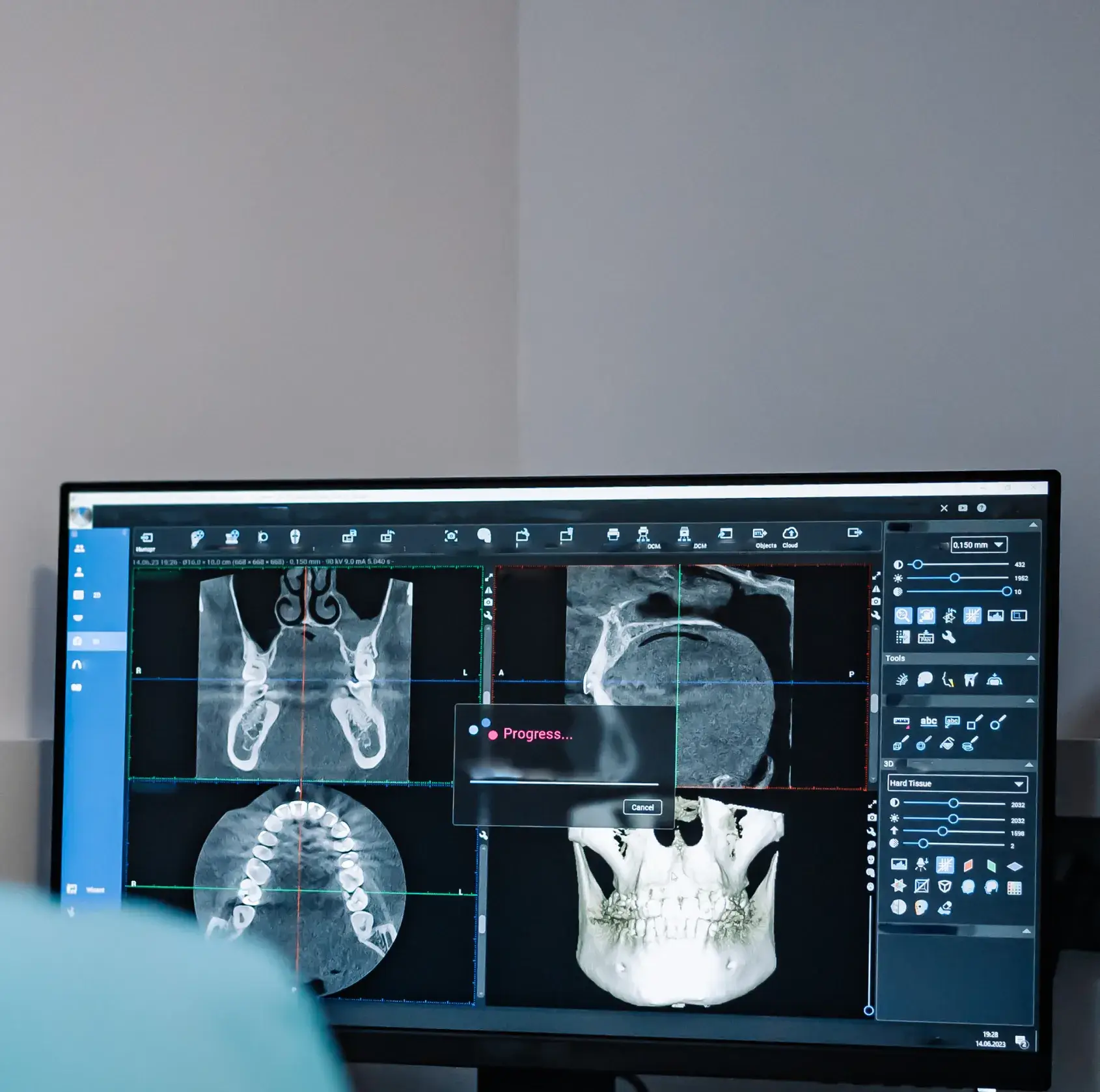 Computer screen displaying 3D dental X-ray images with a progress bar overlay.
