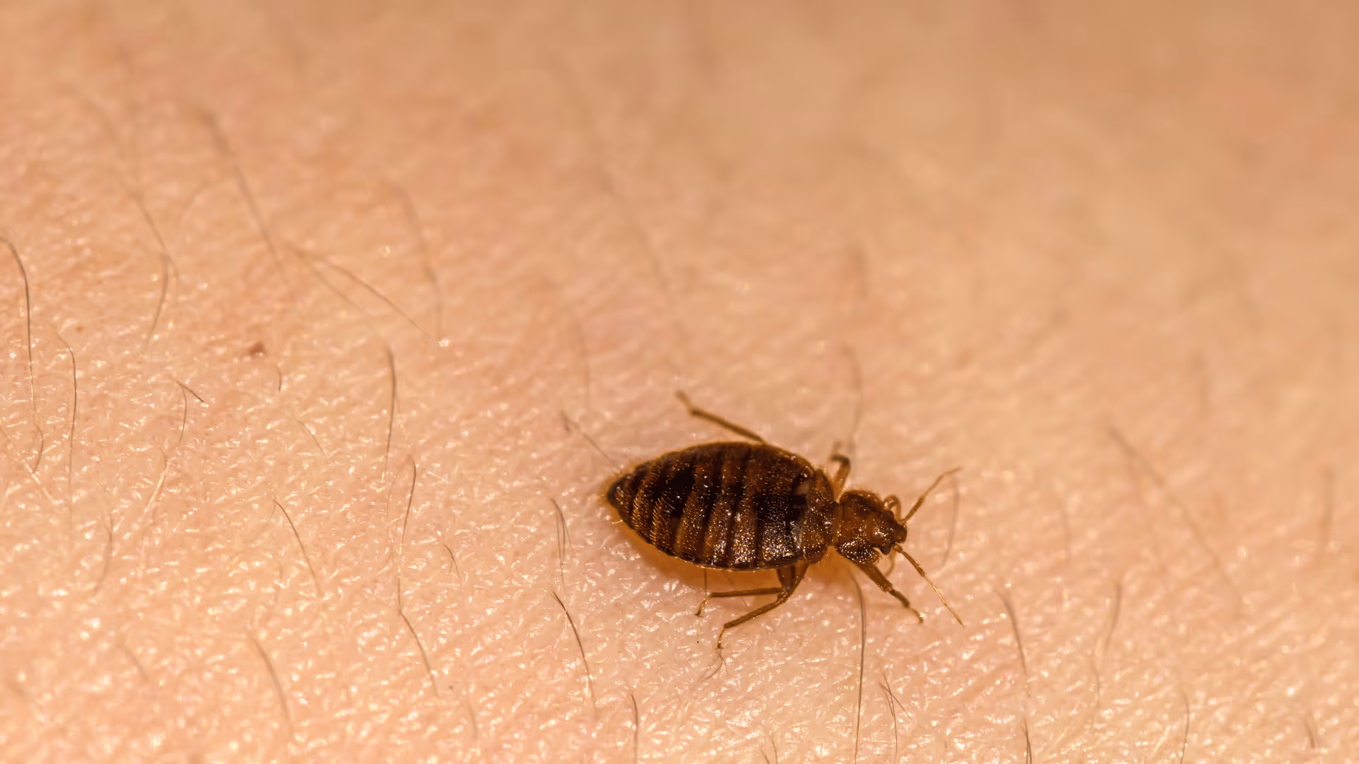 Close-up of a bed bug crawling on human skin with visible hair.