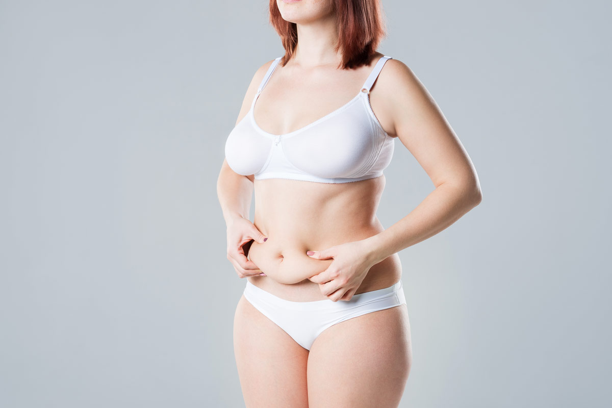 Abdominoplasty