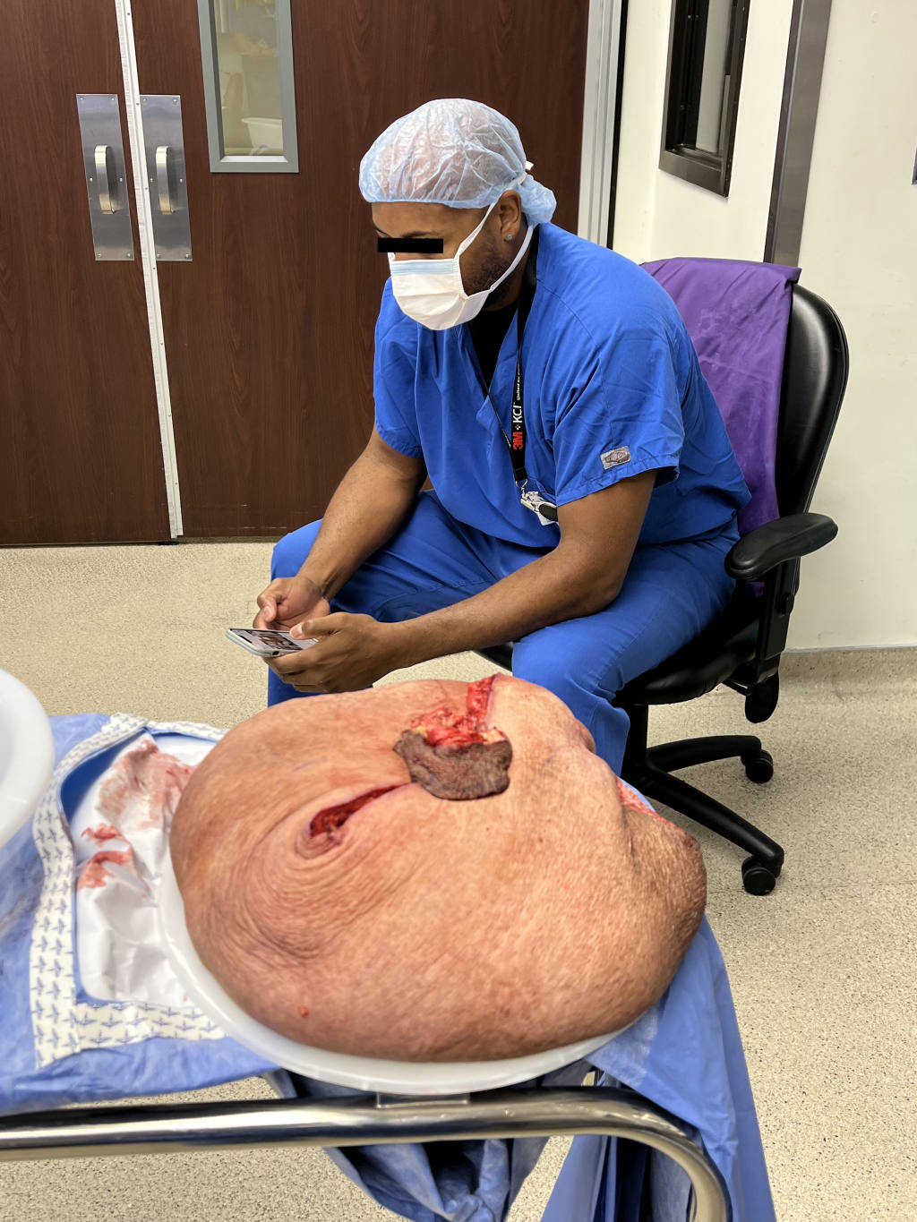 The massive size of lymphocele tumor can be better appreciated when photographed beside the 6' 4" assistant..