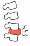spine_pain_icon