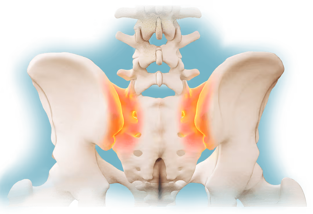 SI Joint Pain