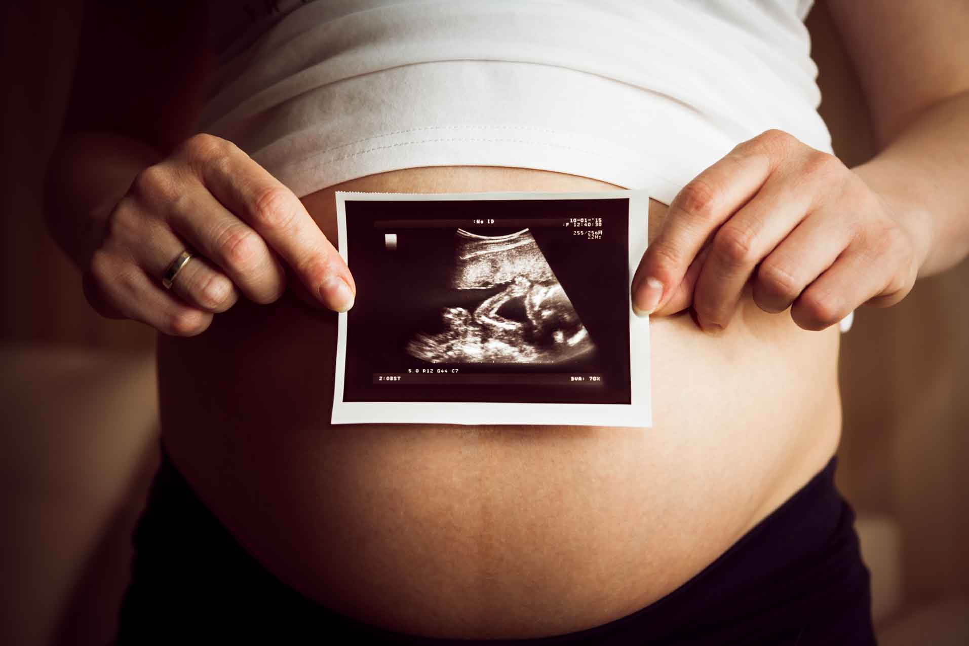 Pregnant woman holding a 2D Ultrasound in front of her belly