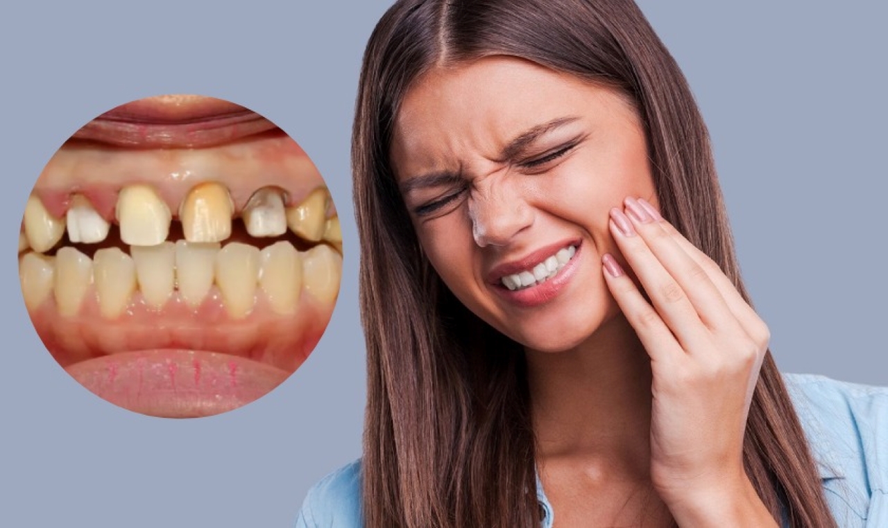 Bọc răng sứ có đau không và cách hạn chế đau nhức
