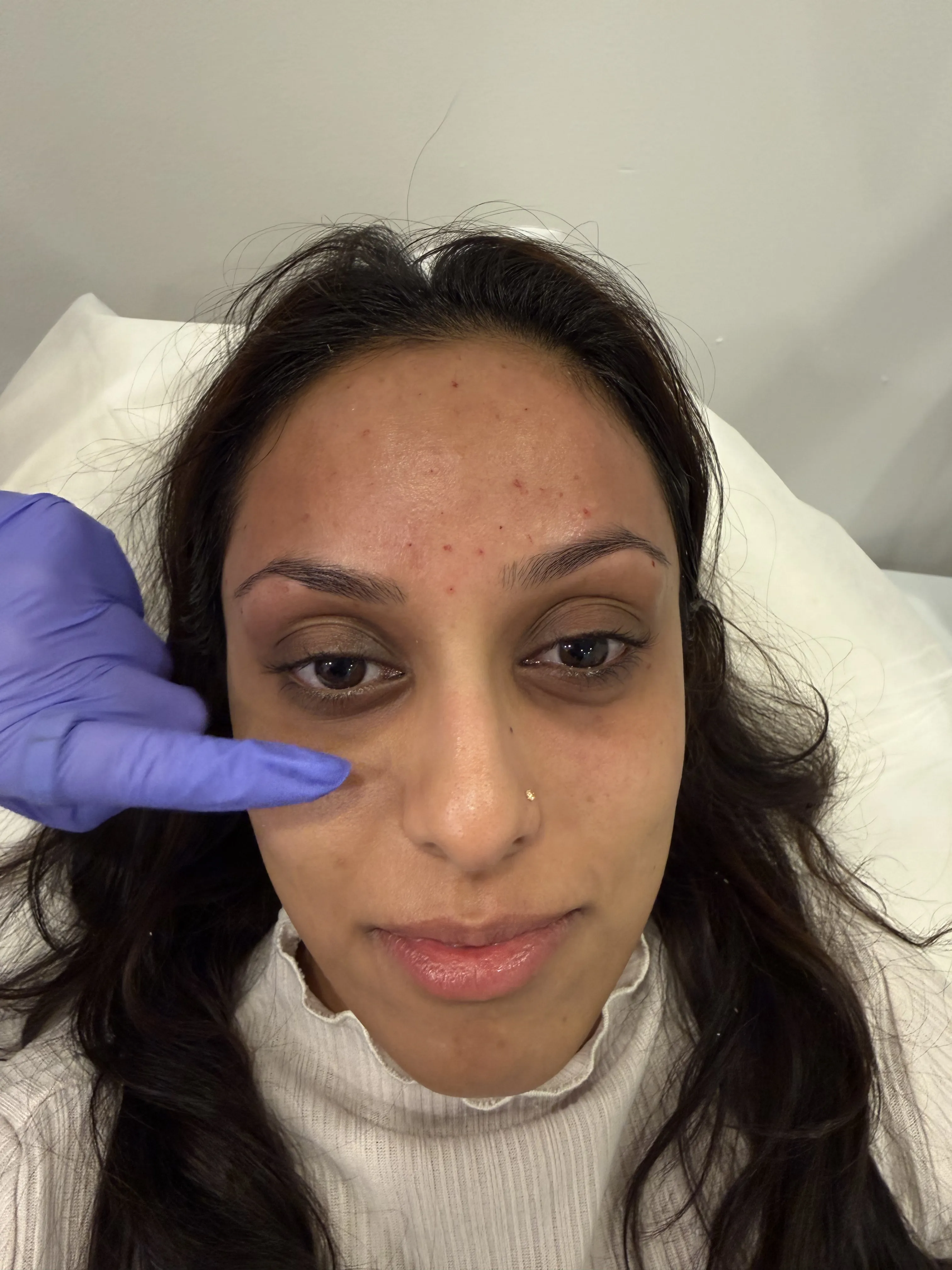 Clinical procedure at Arbour Longevity clinic