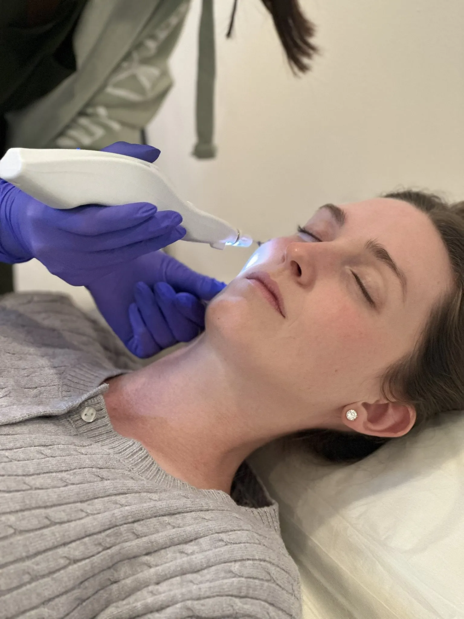 Rockstar PRP treatment with plasma-rich preparation