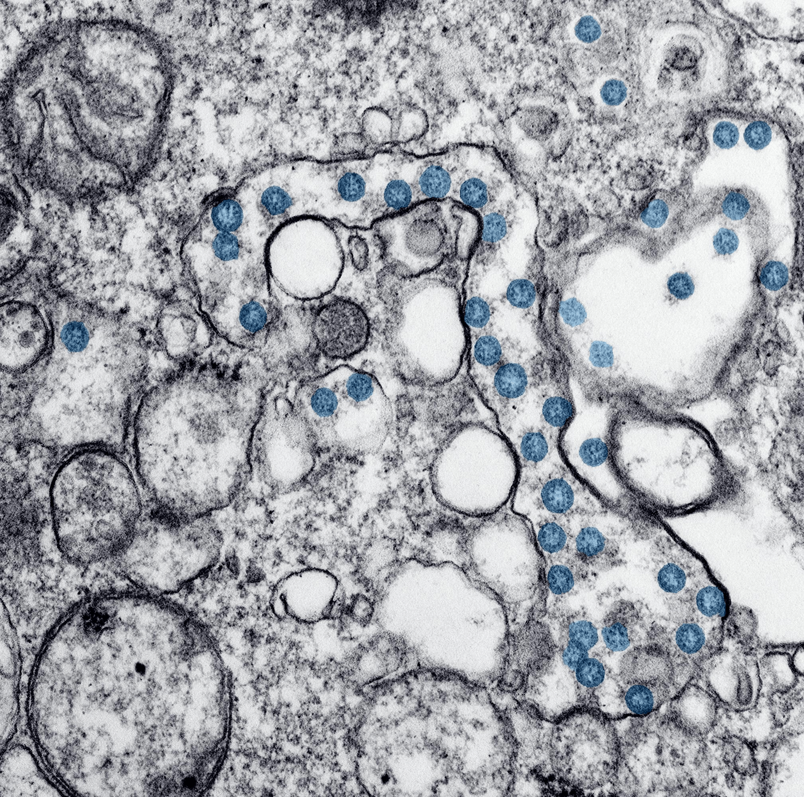 Mouse brain lightsheet microscopy — Wyss Center