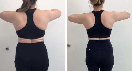 Side-by-side comparison of a woman from the back showing weight loss, with a slimmer waist and reduced back fat on the right.