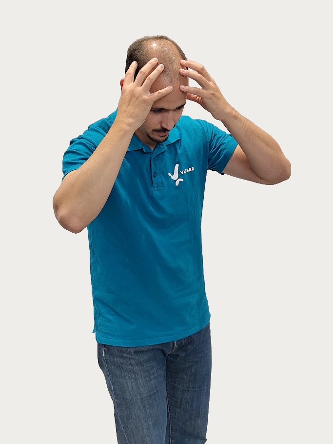 Man met blauwe polo grijpt met beide handen naar zijn voorhoofd en toont pijn of stress.