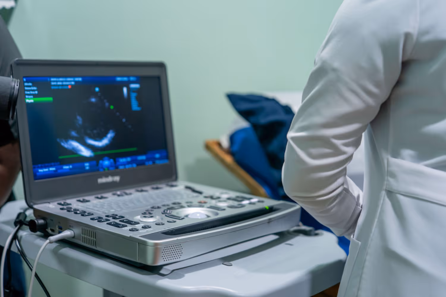 echocardiogram machine in Antigua healthcare