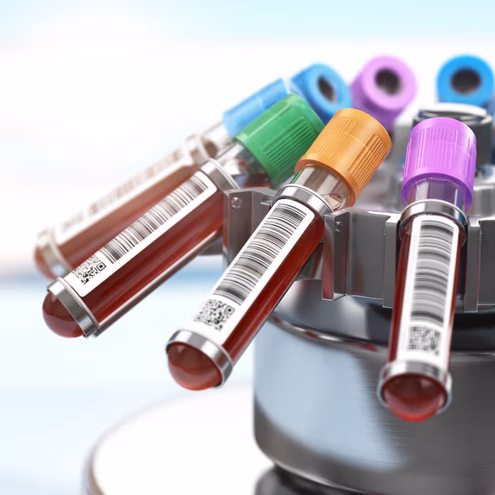 Blood sample tubes with colored caps and barcodes placed in a metal holder.