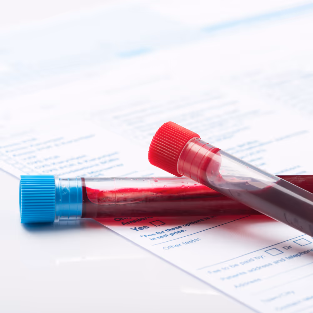 Two blood-filled test tubes with red and blue caps resting on medical forms.