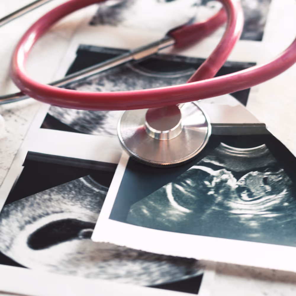 Pink stethoscope resting on black and white ultrasound images of a fetus and early pregnancy.