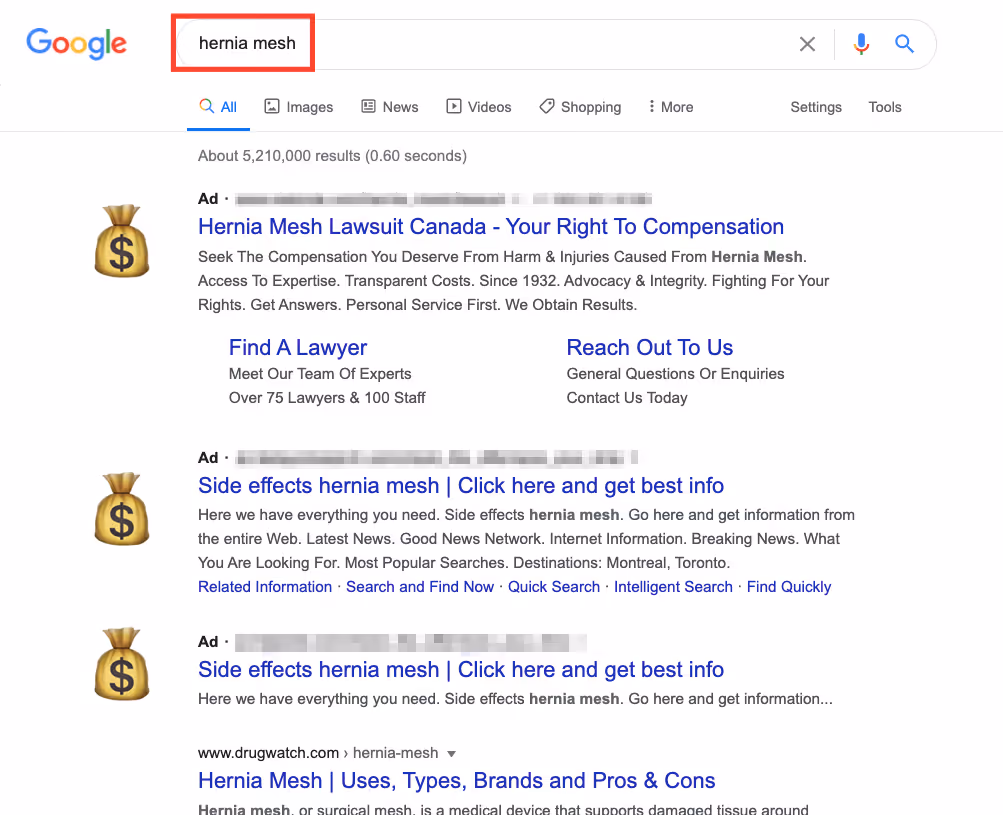 hernia mesh ads