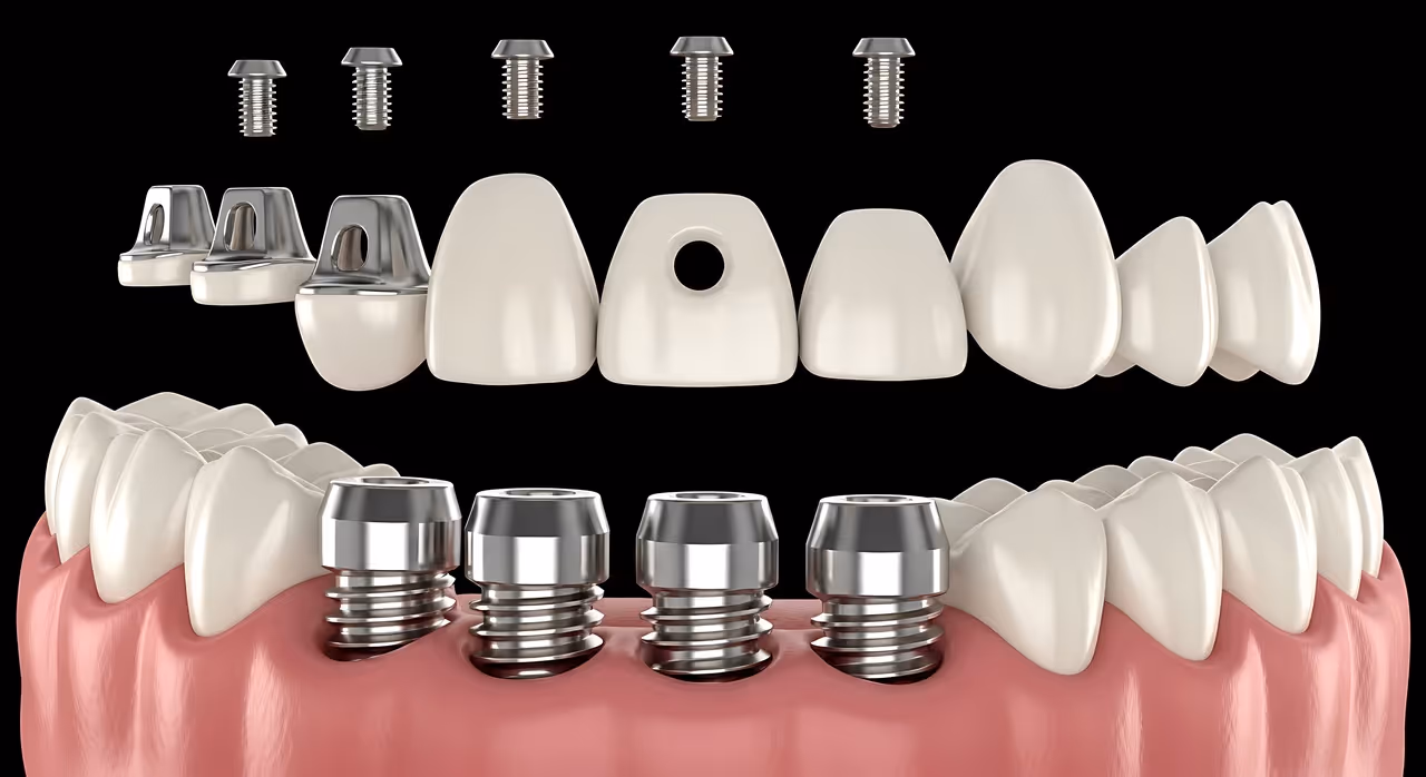 Full Mouth Reconstruction in West Long Branch, NJ