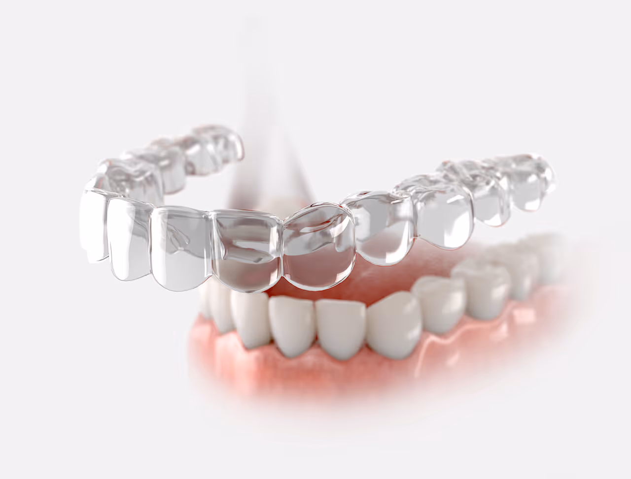 Clear Aligners in West Long Branch, NJ