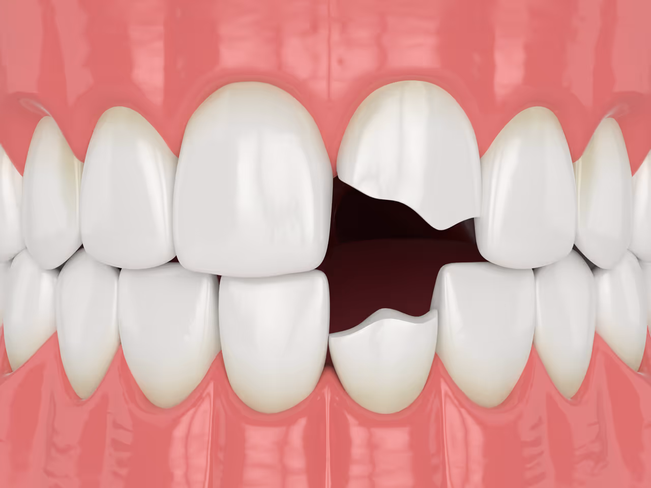 Emergency Dentist in West Long Branch, NJ