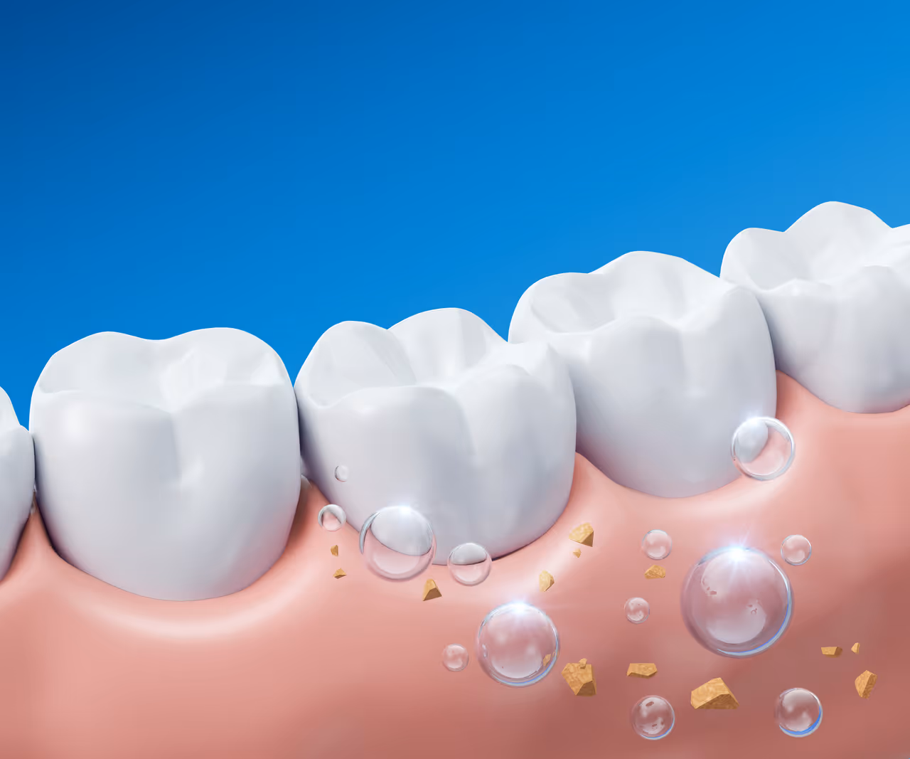 Fluoride Treatment in West Long Branch, NJ