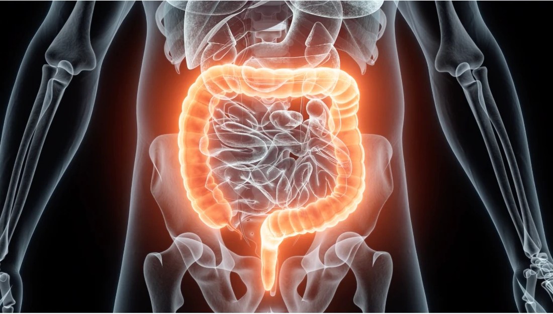 Anatomical illustration of the colon and rectum highlighted within the abdomen