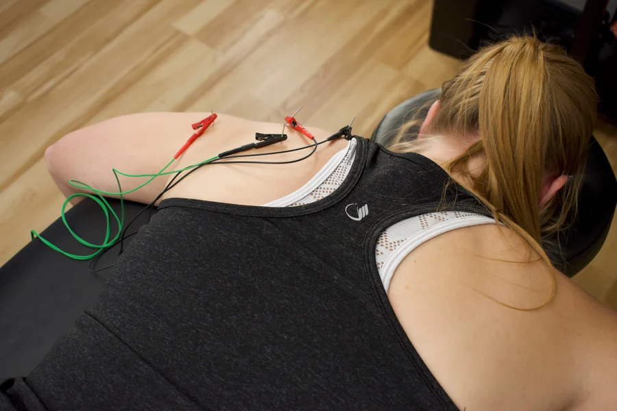 Person lying face down on a treatment table with acupuncture needles and electrode clips on their upper back and shoulder.